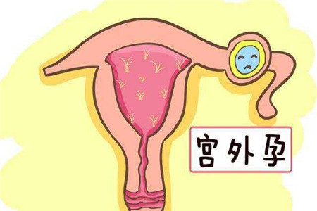 女性患上子宫性不孕的四大症状