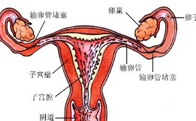 深圳福田怡康妇产医院看输卵管积水怎么样