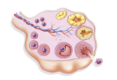 深圳女性腹腔镜治疗卵巢囊肿怎么样